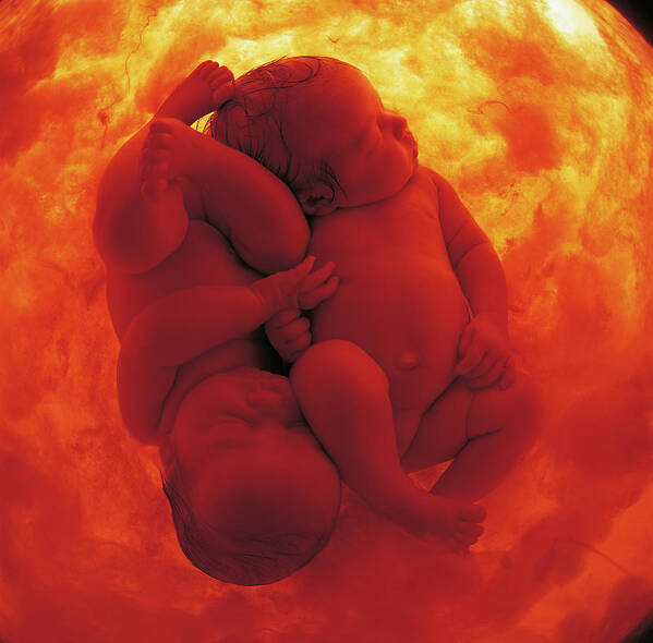 Color Poster featuring the photograph Womb Series #9 by Anne Geddes