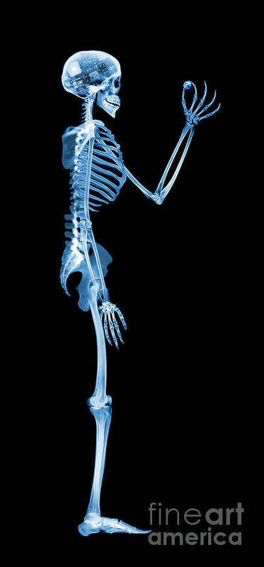 Radiography Art Print featuring the photograph Technological Dominance by D. Roberts/science Photo Library