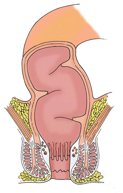 Illustration Of Rectum Art Print by Science Source
 Rectum Drawing