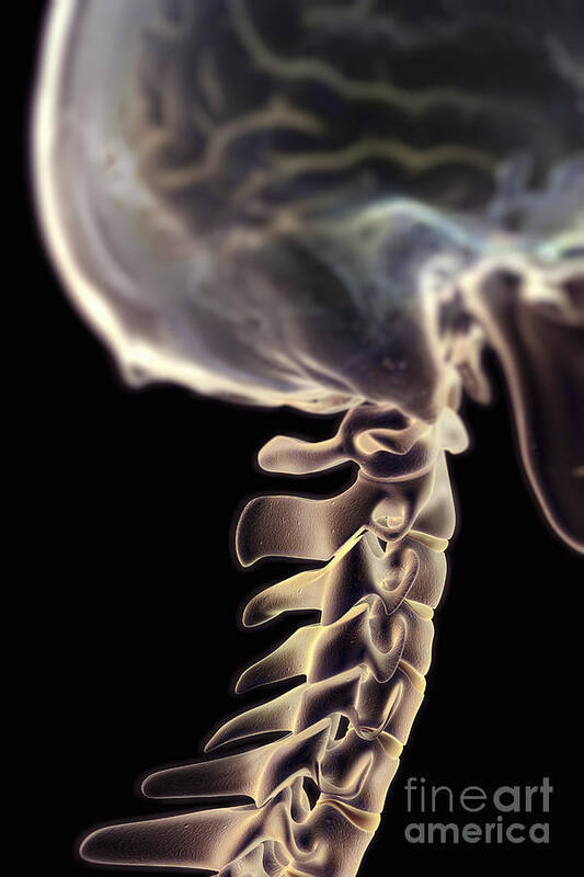 Human Body Art Print featuring the photograph Cervical Vertebrae #4 by Science Picture Co