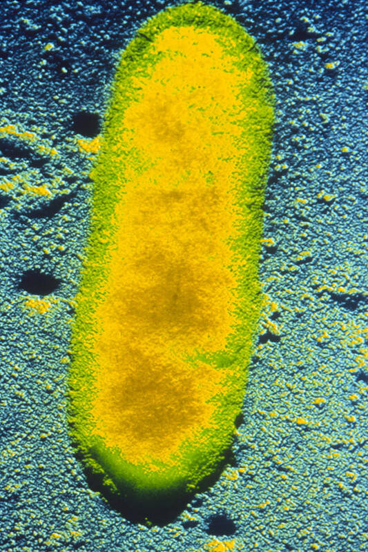 Rickettsia Sp. Art Print featuring the photograph Coloured Tem Of Rickettsiae Bacterium by Cnri