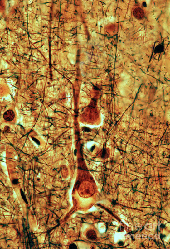 Lipofuscin Art Print featuring the photograph Lipofuscin In Pyramidal Neuron #1 by Jose Calvo / Science Photo Library