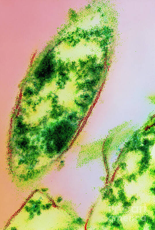 Fusobacterium Nucleatum Art Print featuring the photograph Fusobacterium Nucleatum Bacteria by Dr Kari Lounatmaa/science Photo Library