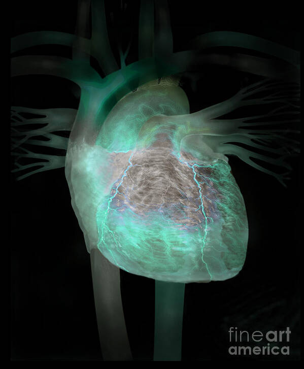 Anatomy Art Print featuring the photograph Human Heart Illustration by Jim Dowdalls