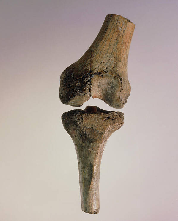 Hominid Fossil Art Print featuring the photograph Knee Joint Of Australopithecus Afarensis by John Reader/science Photo Library