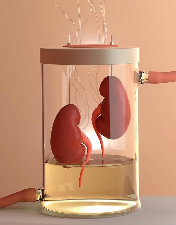 Nobody Art Print featuring the photograph Spare Kidneys by Tim Vernon