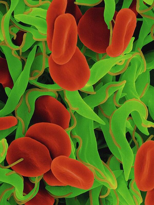 25991c Art Print featuring the photograph Trypanosome Trypomastigote And Red Blood Cells #2 by Dennis Kunkel Microscopy/science Photo Library