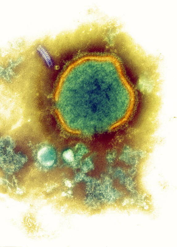 Measles Virus Art Print featuring the photograph Measles Virus, Tem #1 by Nibsc