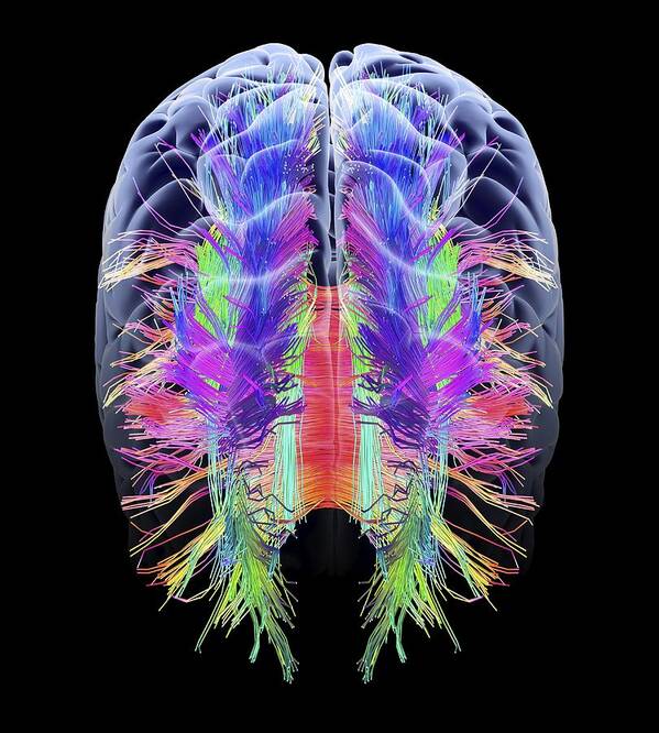 Brain Art Print featuring the photograph White matter fibres and brain, artwork by Science Photo Library