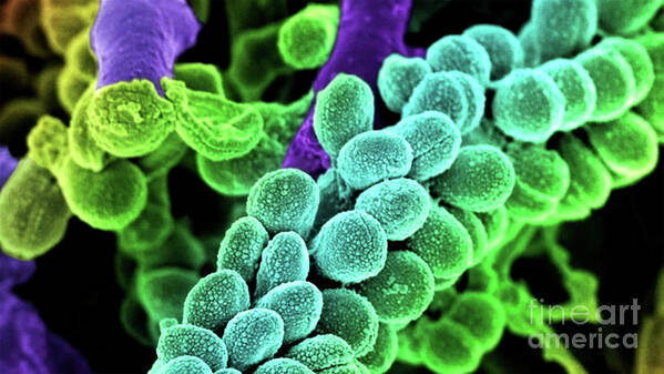 Streptococcus Bacteria Art Print featuring the photograph Streptococcus Bacteria - Colored scanning electron micrograph. by Doc Braham