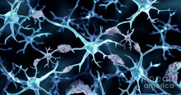 Neurons Art Print featuring the photograph Alzheimer's Disease by Artur Plawgo / Science Photo Library