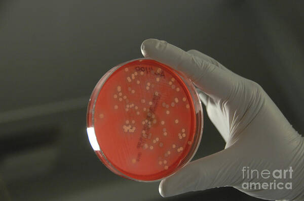Horizontal Art Print featuring the photograph Bacteria From Human Skin Grown On Agar #1 by National Institutes of Health