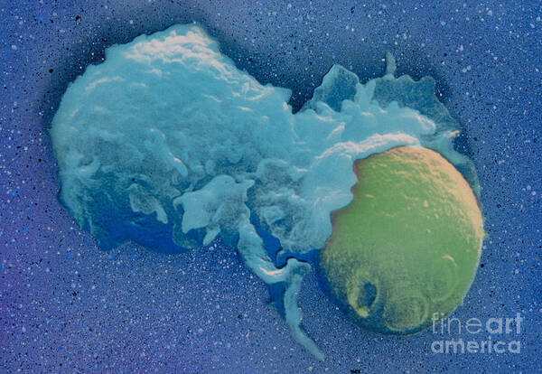 Sem Image Art Print featuring the photograph Macrophage Englufing Yeast Cell #1 by Biology Pics