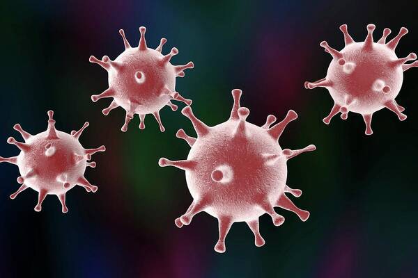 Artwork Art Print featuring the photograph Herpes Simplex Virus #5 by Kateryna Kon