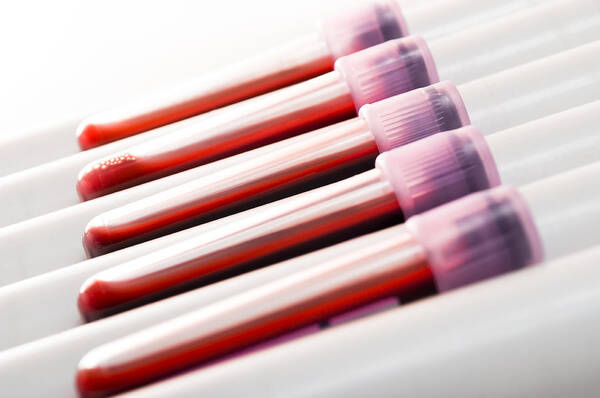 Medical Research Art Print featuring the photograph Blood samples (shallow DOF) by Zoran Kolundzija