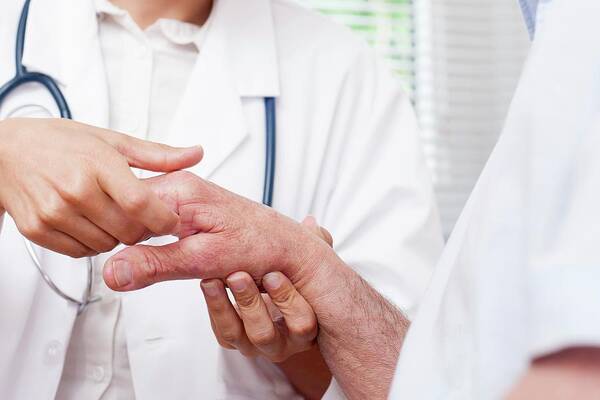 30-34 Years Art Print featuring the photograph Nurse Checking Man's Hand Joints by Science Photo Library