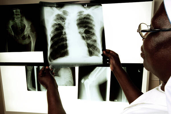 Film Art Print featuring the photograph Radiographer Looking At X-rays by Mauro Fermariello/science Photo Library