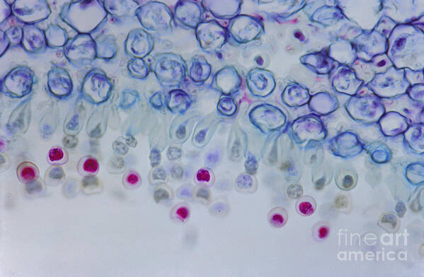 Fungi Art Print featuring the photograph Conidia On Host by M. I. Walker