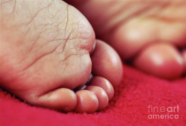 9 Months Old Art Print featuring the photograph Baby's Feet #4 by Paul Whitehill/science Photo Library