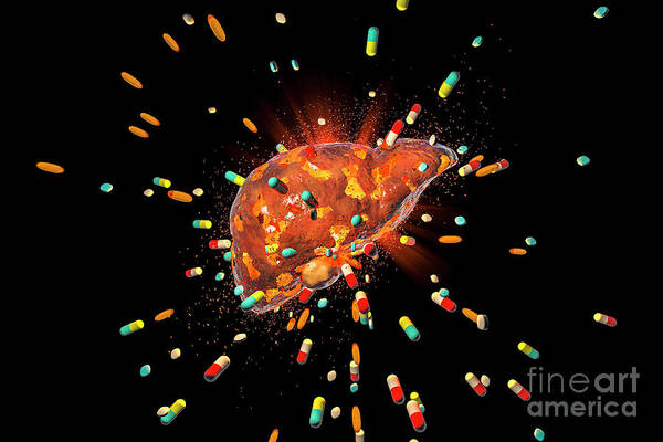 3 Dimensional Art Print featuring the photograph Drug-induced Hepatotoxicity #4 by Kateryna Kon/science Photo Library