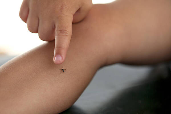 Child Art Print featuring the photograph A mosquito on small kid's leg by Thanasis Zovoilis