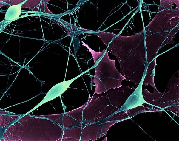 Astrocyte Art Print featuring the photograph Pyramidal Neurons From Cns #5 by Dennis Kunkel Microscopy/science Photo Library