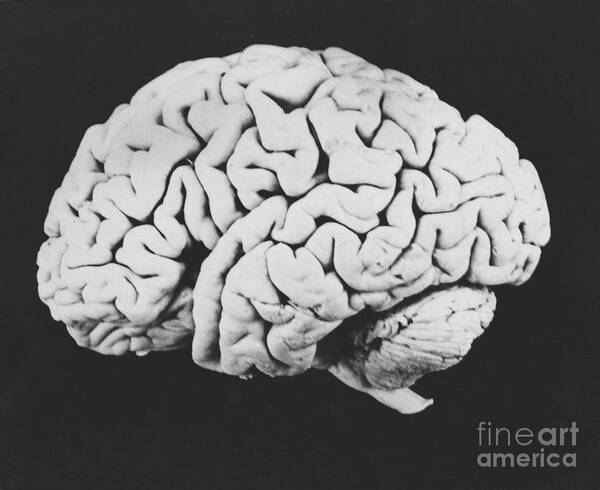 Brain Art Print featuring the photograph Human Brain #5 by Omikron