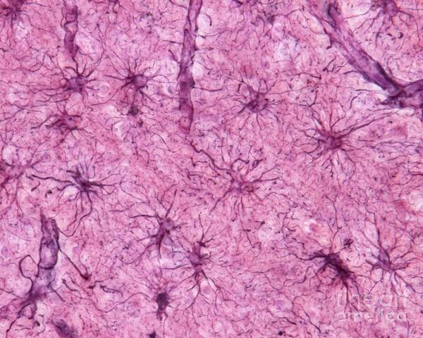 Astrocyte Art Print featuring the photograph Astrocytes #4 by Jose Calvo / Science Photo Library