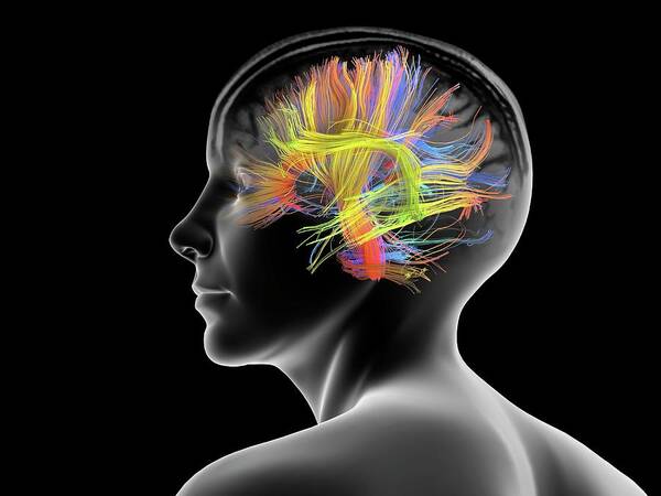 Human Brain Scan Matte/Glossy PosterWellcoda 