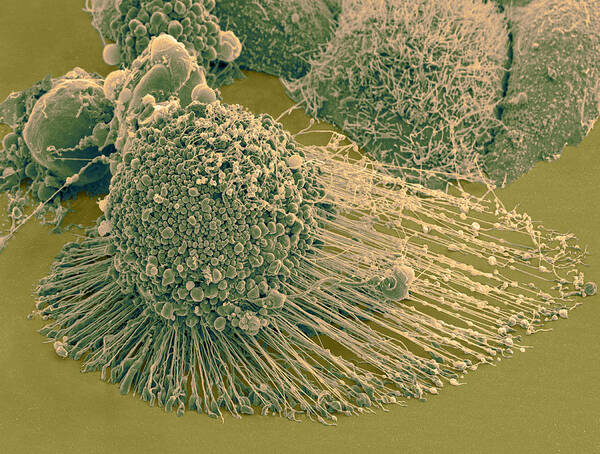 Science Art Print featuring the photograph Apoptotic Hela Cell, Sem #3 by Science Source