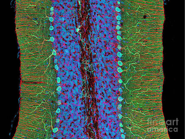 Science Art Print featuring the photograph Cerebellum, Fluorescent Lm by Science Source