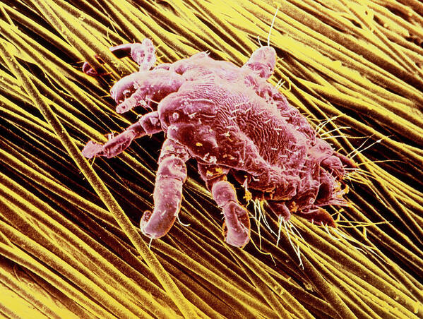 Coloured Sem Of Pubic Louse On Pubic Hair Art Print by E. Gray/science  Photo Library - Science Photo Gallery