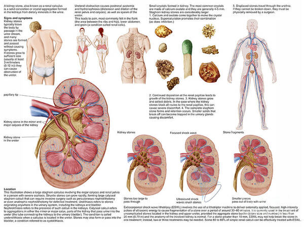 Healthcare Art Print featuring the digital art Medical Chart Showing The Signs by Stocktrek Images