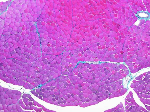 Tissue Art Print featuring the photograph Skeletal Muscle Tissue by Microscape