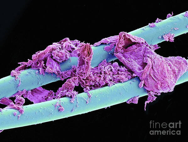 Bacteria Art Print featuring the photograph Used Dental Floss SEM by Spl