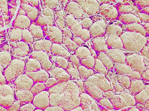 Pancreas Art Print featuring the photograph Pancreas Surface, Sem #1 by Susumu Nishinaga