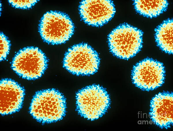 Medical Art Print featuring the photograph Adenovirus Tem by Omikron