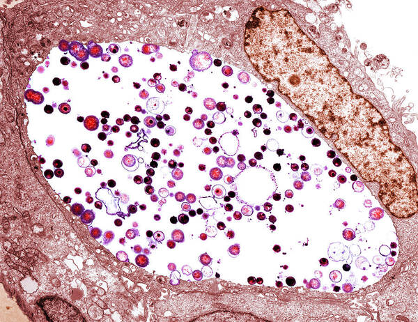 Chlamydia Trachomatis Art Print featuring the photograph Chlamydia Trachomatis Bacteria, Tem by Biomedical Imaging Unit, Southampton General Hospital