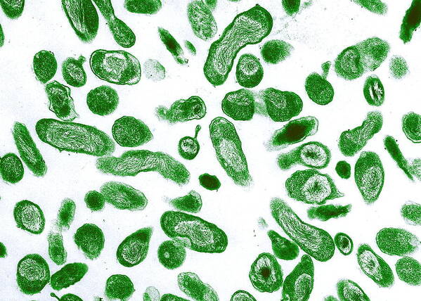 Coxiella Burnetii Art Print featuring the photograph Q Fever Bacteria, Coxiella Burnetii, Tem by Niaidcdc