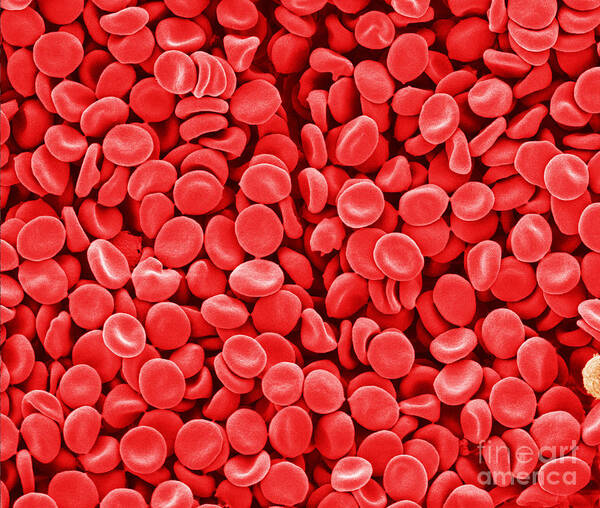 Red Blood Cells Art Print featuring the photograph Red Blood Cells, Sem #4 by Scimat