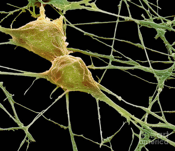  Differentiation Art Print featuring the photograph Neurons #2 by Steve Gschmeissner/science Photo Library