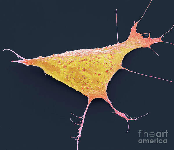 Anatomical Art Print featuring the photograph Human Induced Pluripotent Cell. #6 by Steve Gschmeissner/science Photo Library