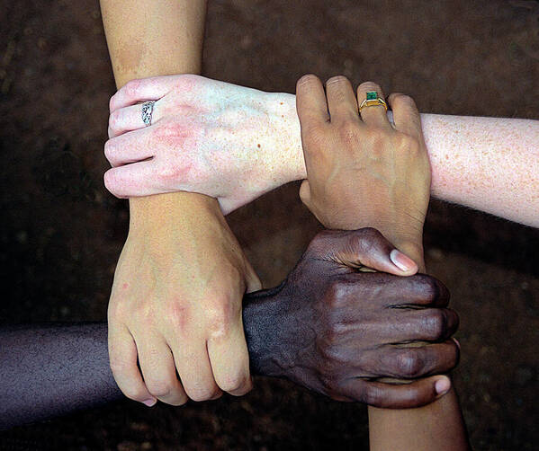 Arm Art Print featuring the photograph United Diversity by Benton Murphy Md