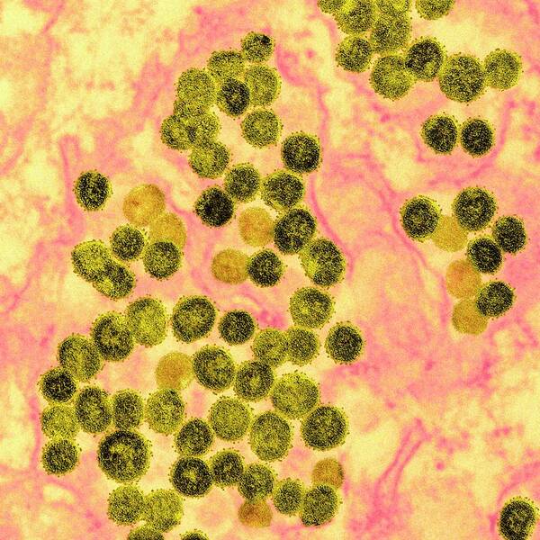 Nobody Art Print featuring the photograph Mers Coronavirus Particles #3 by Ami Images