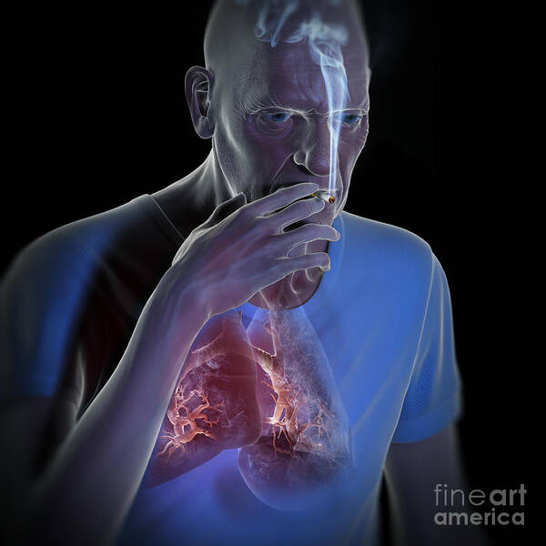 3d Visualisation Art Print featuring the photograph Dangers Of Smoking #5 by Science Picture Co