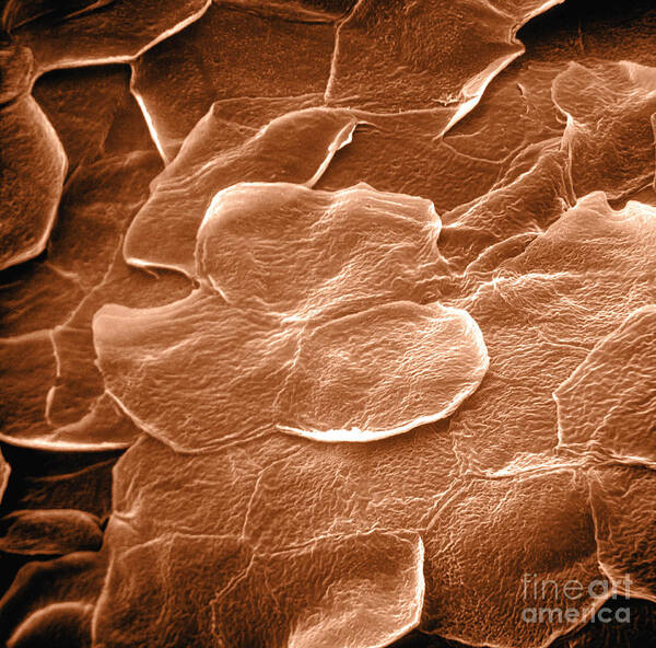 Sem Art Print featuring the photograph Sem Of Human Skin #9 by David M. Phillips