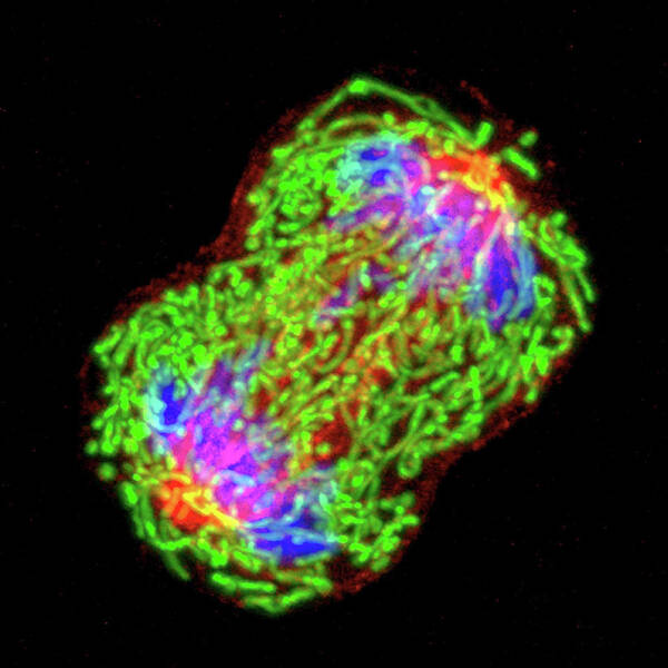 Cell Art Print featuring the photograph Dividing Breast Cancer Cell by University Of Pittsburgh Cancer Institute/national Cancer Institute/science Photo Library