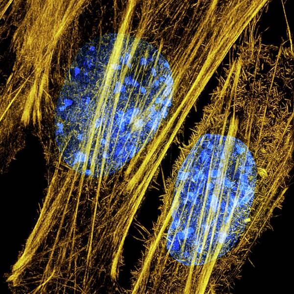 Actin Art Print featuring the photograph Fibroblasts by Dr Lothar Schermelleh