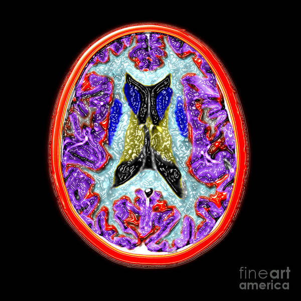 Magnetic Resonance Imaging Art Print featuring the photograph Cross-sectional Mri Of The Human Brain by Medical Body Scans