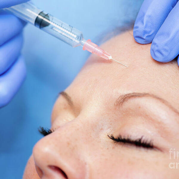 Botox Art Print featuring the photograph Botox Treatment #1 by Microgen Images/science Photo Library